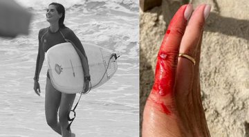 Isabela acabou se machucando enquanto treinava surf no Guarujá - Reprodução/Instagram