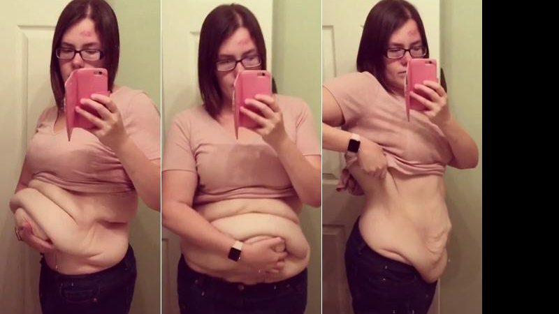 Amanda Roberts eliminou 63 quilos após cirurgia bariátrica - Foto: Reprodução/ Instagram