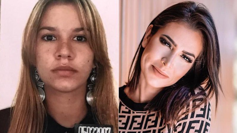 Adriana Sant’Anna antes e depois de cirurgia plástica no nariz - Foto: Reprodução/ Instagram